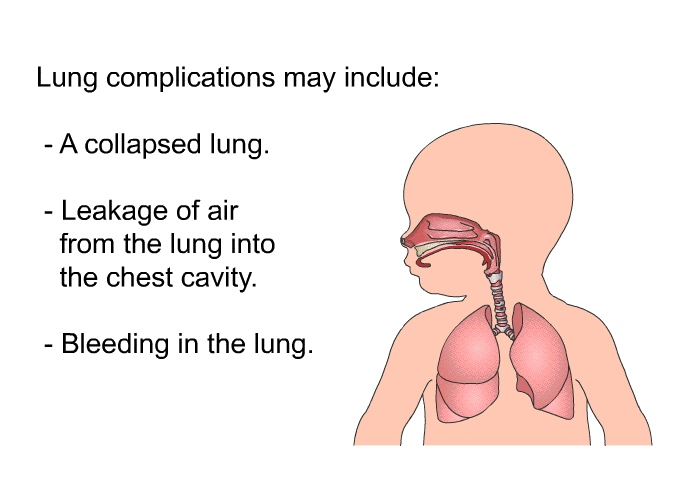 Lung complications may include:  A collapsed lung. Leakage of air from the lung into the chest cavity. Bleeding in the lung.