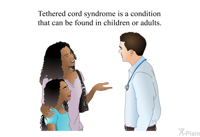 Tethered cord syndrome is a condition that can be found in children or adults.