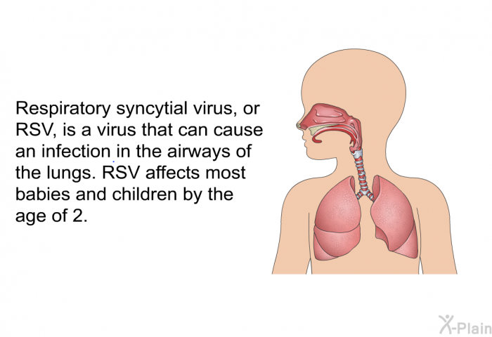 Respiratory syncytial virus, or RSV, is a virus that can cause an infection in the airways of the lungs. RSV affects most babies and children by the age of 2.