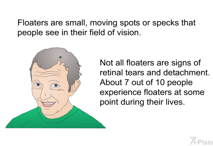 Floaters are small, moving spots or specks that people see in their field of vision. Not all floaters are signs of retinal tears and detachment. About 7 out of 10 people experience floaters at some point during their lives.