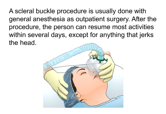 A scleral buckle procedure is usually done with general anesthesia as outpatient surgery. After the procedure, the person can resume most activities within several days, except for anything that jerks the head.
