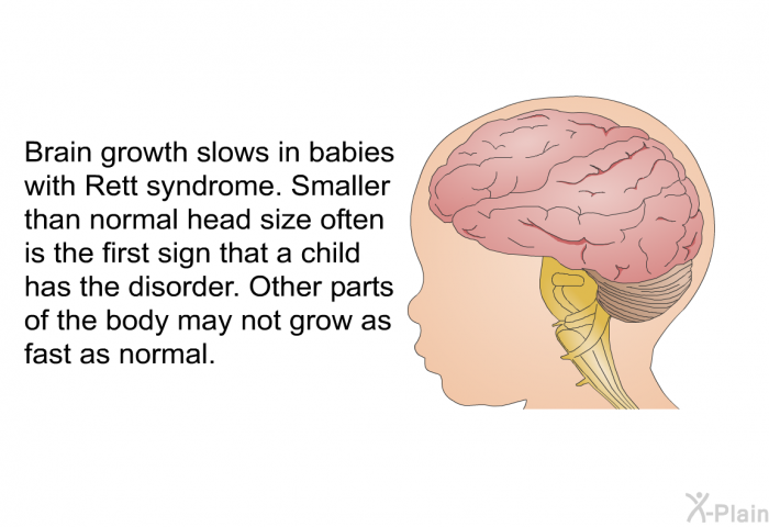 Brain growth slows in babies with Rett syndrome. Smaller than normal head size often is the first sign that a child has the disorder. Other parts of the body may not grow as fast as normal.