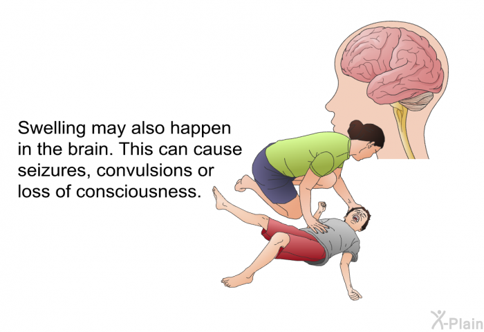 Swelling may also happen in the brain. This can cause seizures, convulsions or loss of consciousness.