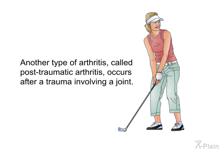 Another type of arthritis, called post-traumatic arthritis, occurs after a trauma involving a joint.