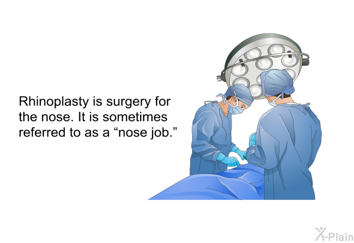 Rhinoplasty is surgery for the nose. It is sometimes referred to as a “nose job.”