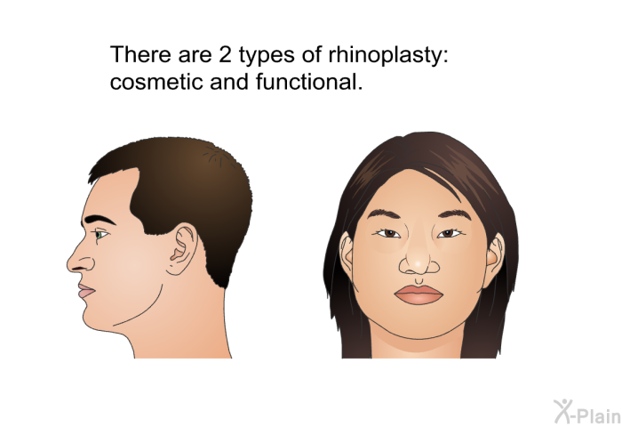 There are 2 types of rhinoplasty: cosmetic and functional.