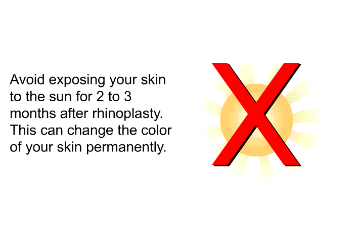 Avoid exposing your skin to the sun for 2 to 3 months after rhinoplasty. This can change the color of your skin permanently.