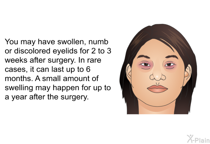 You may have swollen, numb or discolored eyelids for 2 to 3 weeks after surgery. In rare cases, it can last up to 6 months. A small amount of swelling may happen for up to a year after the surgery.