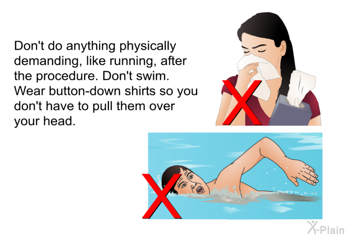 Don't do anything physically demanding, like running, after the procedure. Don't swim. Wear button-down shirts so you don't have to pull them over your head.