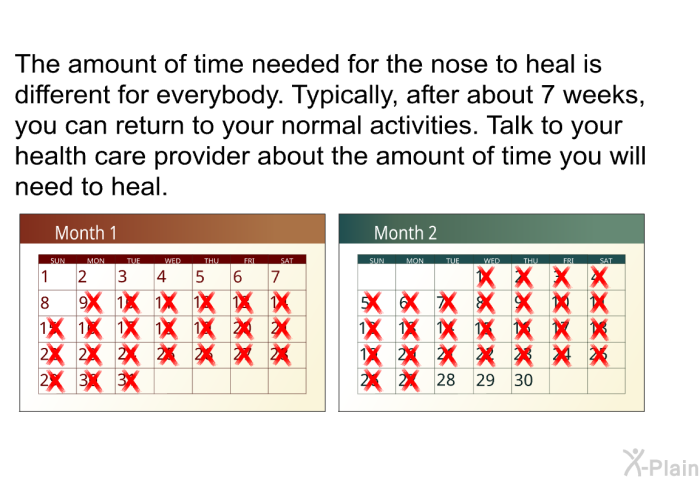The amount of time needed for the nose to heal is different for everybody. Typically, after about 7 weeks, you can return to your normal activities. Talk to your health care provider about the amount of time you will need to heal.