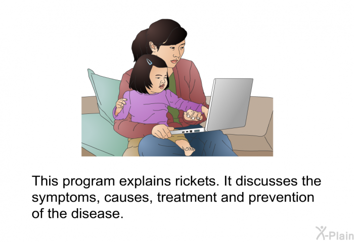 This health information explains rickets. It discusses the symptoms, causes, treatment and prevention of the disease.