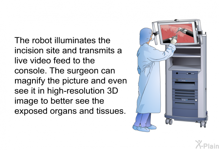 The robot illuminates the incision site and transmits a live video feed to the console. The surgeon can magnify the picture and even see it in high-resolution 3D image to better see the exposed organs and tissues.