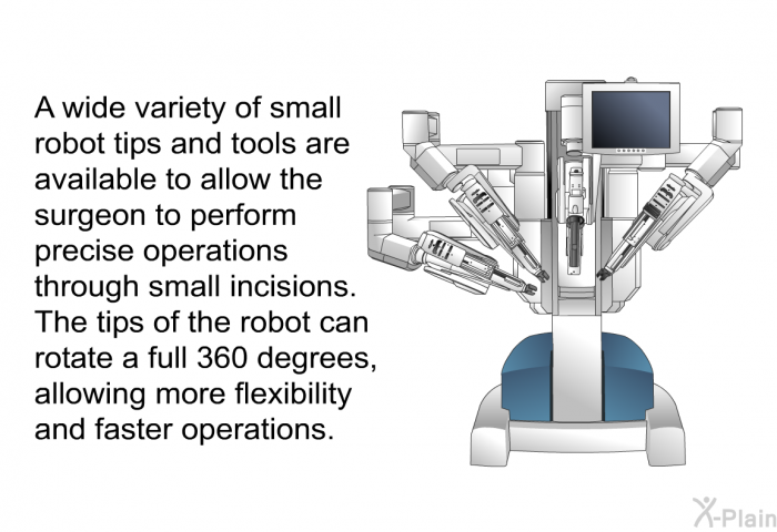 A wide variety of small robot tips and tools are available to allow the surgeon to perform precise operations through small incisions. The tips of the robot can rotate a full 360 degrees, allowing more flexibility and faster operations.