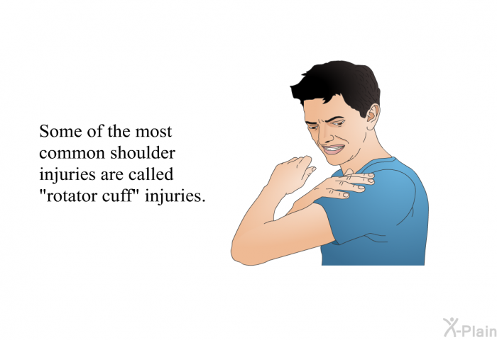 Some of the most common shoulder injuries are called “rotator cuff” injuries.