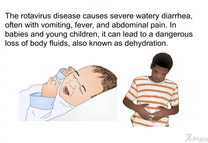 The rotavirus disease causes severe watery diarrhea, often with vomiting, fever, and abdominal pain. In babies and young children, it can lead to a dangerous loss of body fluids, also known as dehydration.