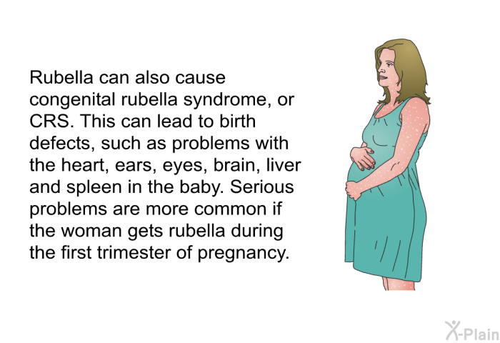 Rubella can also cause congenital rubella syndrome, or CRS. This can lead to birth defects, such as problems with the heart, ears, eyes, brain, liver and spleen in the baby. Serious problems are more common if the woman gets rubella during the first trimester of pregnancy.