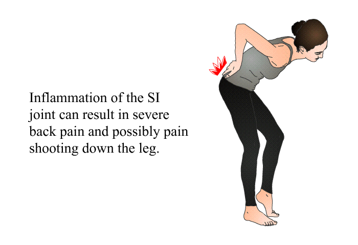 Inflammation of the SI joint can result in severe back pain and possibly pain shooting down the leg.