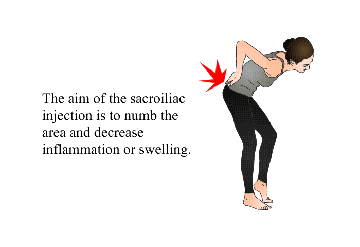 The aim of the sacroiliac injection is to numb the area and decrease inflammation or swelling.