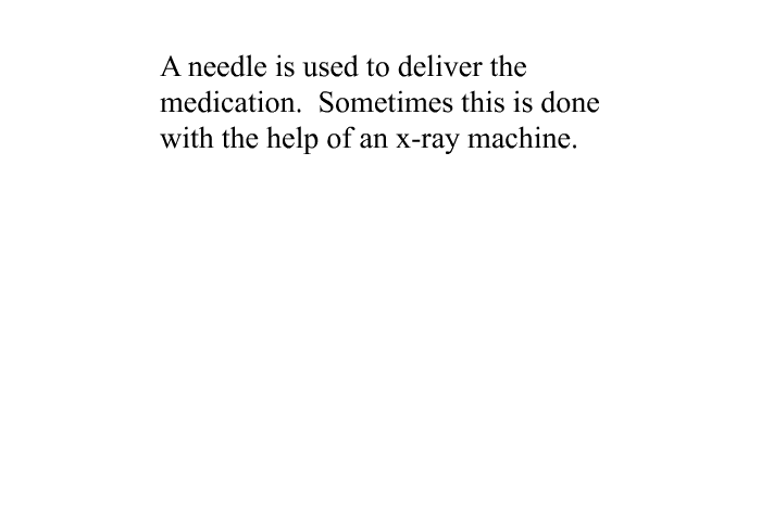 A needle is used to deliver the medication. Sometimes this is done with the help of an x-ray machine.
