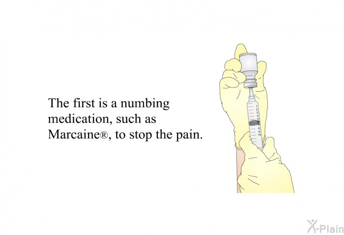 The first is a numbing medication, such as Marcaine , to stop the pain.
