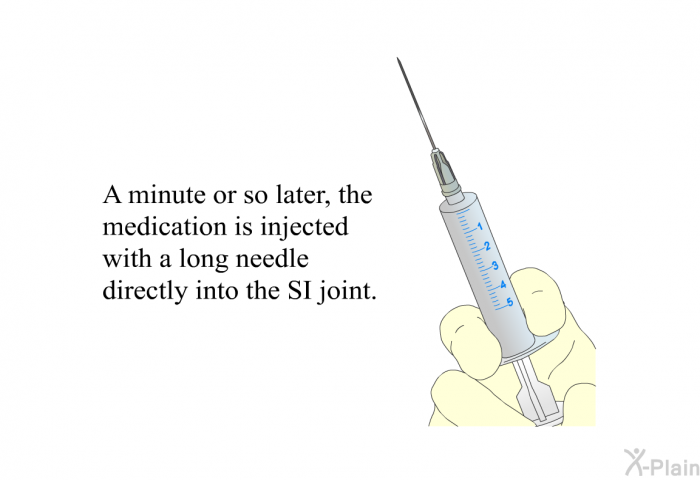 A minute or so later, the medication is injected with a long needle directly into the SI joint.