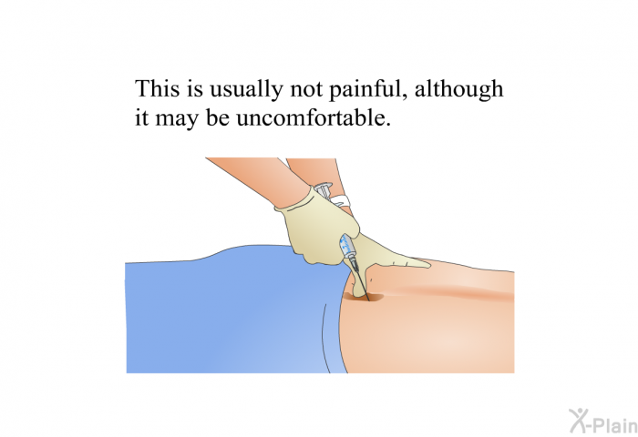 This is usually not painful, although it may be uncomfortable.