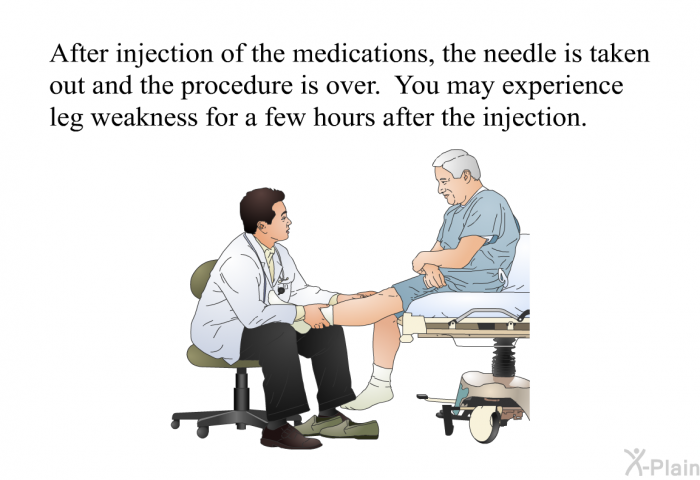 After injection of the medications, the needle is taken out and the procedure is over. You may experience leg weakness for a few hours after the injection.