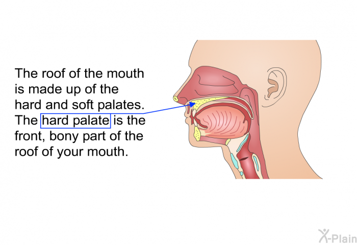The roof of the mouth is made up of the hard and soft palates. The hard palate is the front, bony part of the roof of your mouth.