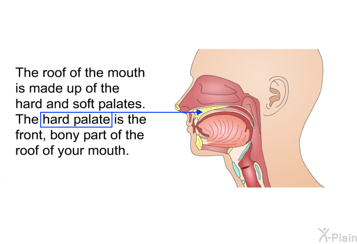 The roof of the mouth is made up of the hard and soft palates. The hard palate is the front, bony part of the roof of your mouth.