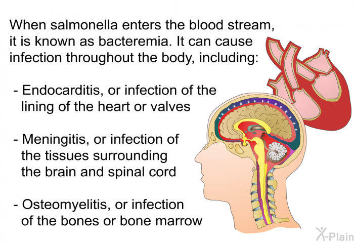 When salmonella enters the blood stream, it is known as bacteremia. It can cause infection throughout the body, including:  Endocarditis, or infection of the lining of the heart or valves Meningitis, or infection of the tissues surrounding the brain and spinal cord Osteomyelitis, or infection of the bones or bone marrow