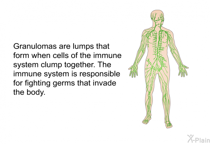 Granulomas are lumps that form when cells of the immune system clump together. The immune system is responsible for fighting germs that invade the body.