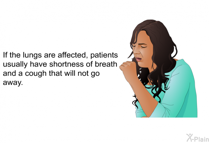 If the lungs are affected, patients usually have shortness of breath and a cough that will not go away.