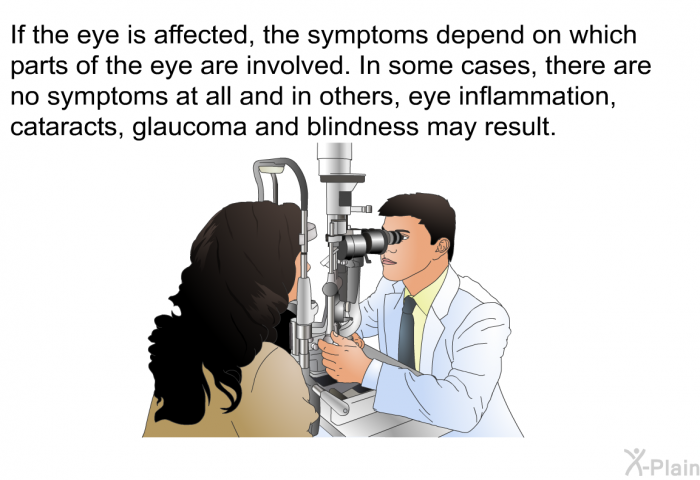 If the eye is affected, the symptoms depend on which parts of the eye are involved. In some cases, there are no symptoms at all and in others, eye inflammation, cataracts, glaucoma and blindness may result.