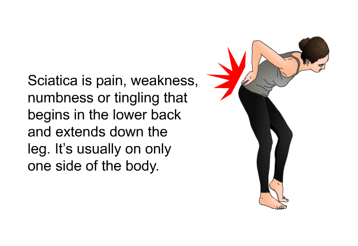 Sciatica is pain, weakness, numbness or tingling that begins in the lower back and extends down the leg. It's usually on only one side of the body.