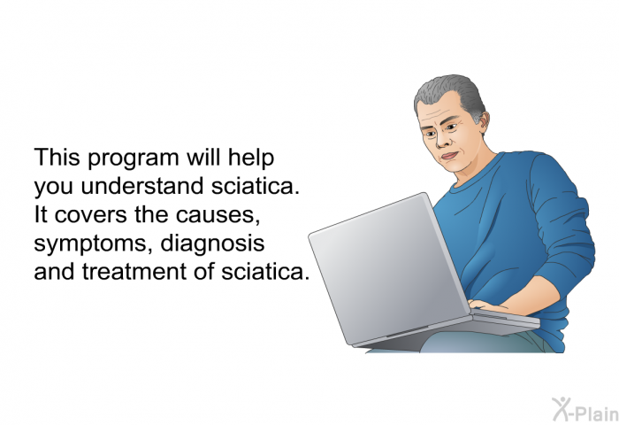 This health information will help you understand sciatica. It covers the causes, symptoms, diagnosis and treatment of sciatica.