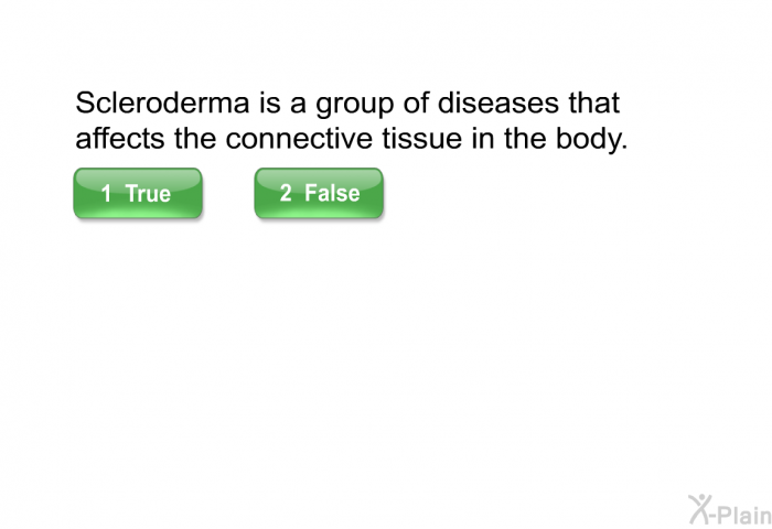 Scleroderma is a group of diseases that affects the connective tissue in the body. Select True or False.
