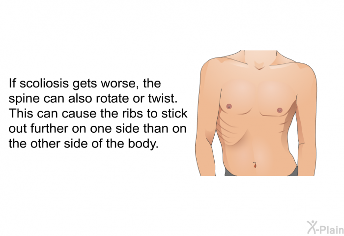 If scoliosis gets worse, the spine can also rotate or twist. This can cause the ribs to stick out further on one side than on the other side of the body.