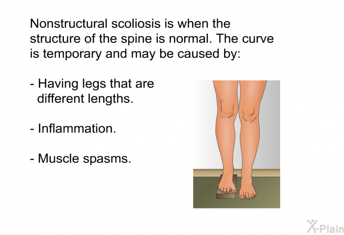 Nonstructural scoliosis is when the structure of the spine is normal. The curve is temporary and may be caused by:  Having legs that are different lengths. Inflammation. Muscle spasms.