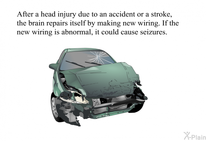 After a head injury due to an accident or a stroke, the brain repairs itself by making new wiring. If the new wiring is abnormal, it could cause seizures.