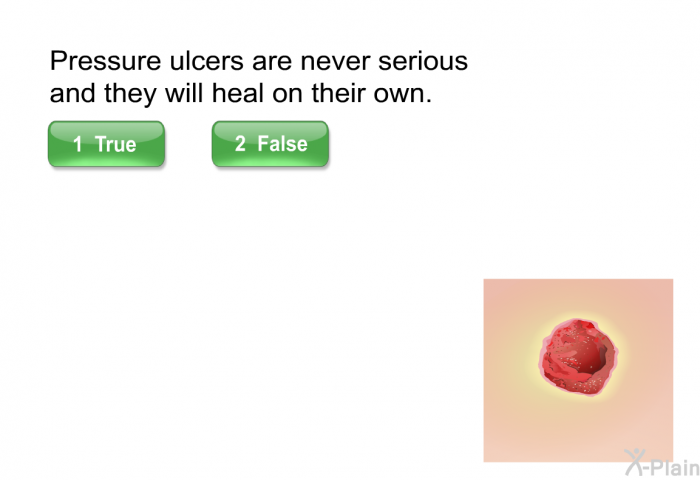 Pressure ulcers are never serious and they will heal on their own.
