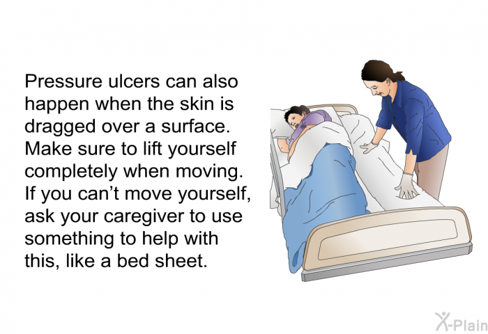 Pressure ulcers can also happen when the skin is dragged over a surface. Make sure to lift yourself completely when moving. If you can't move yourself, ask your caregiver to use something to help with this, like a bed sheet.