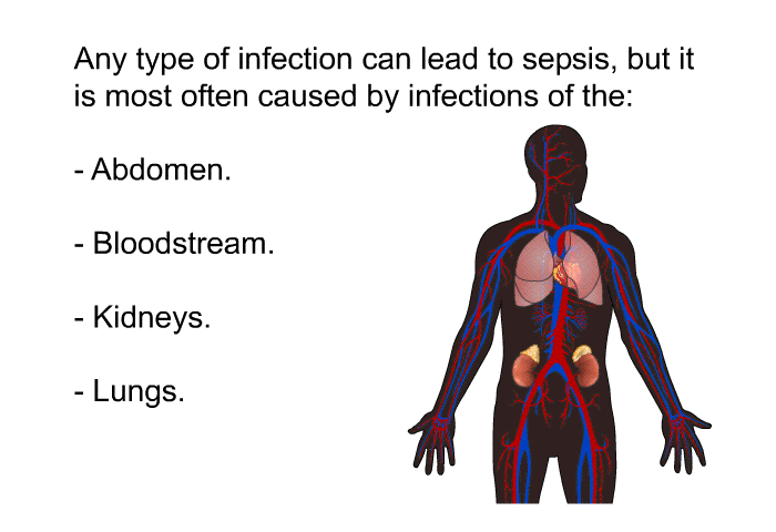 Any type of infection can lead to sepsis, but it is most often caused by infections of the:  Abdomen. Bloodstream. Kidneys. Lungs.