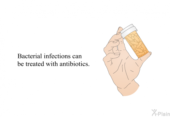 Bacterial infections can be treated with antibiotics.