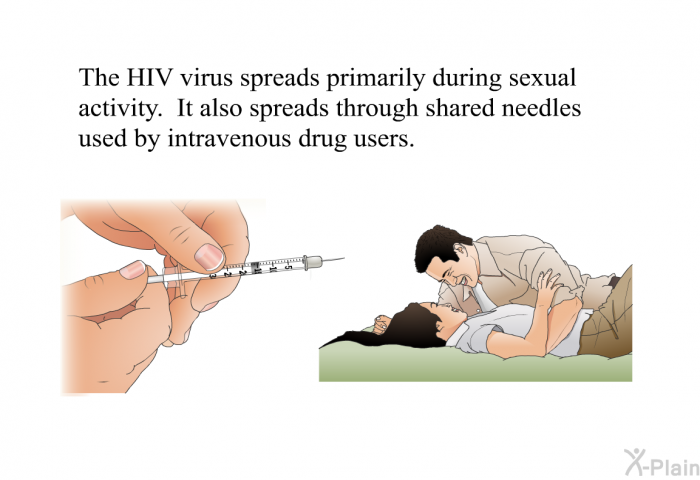 The HIV virus spreads primarily during sexual activity. It also spreads through shared needles used by intravenous drug users.