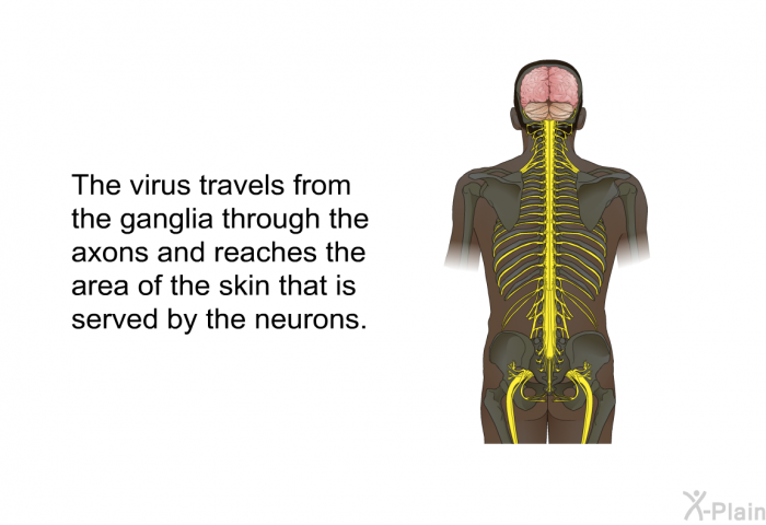The virus travels from the ganglia through the axons and reaches the area of the skin that is served by the neurons.