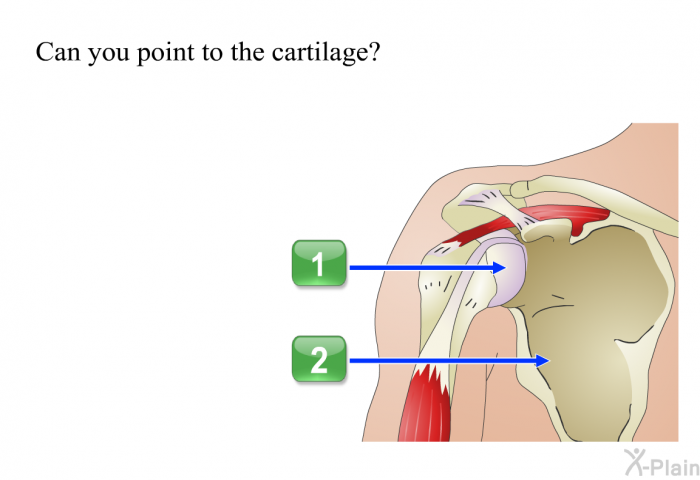 Can you point to the cartilage?