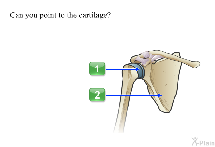 Can you point to the cartilage?