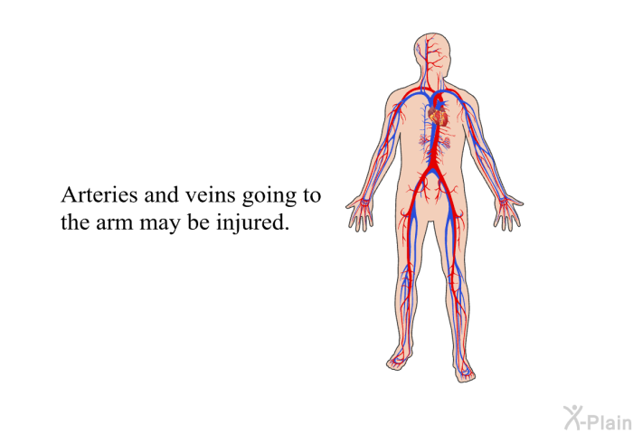 Arteries and veins going to the arm may be injured.
