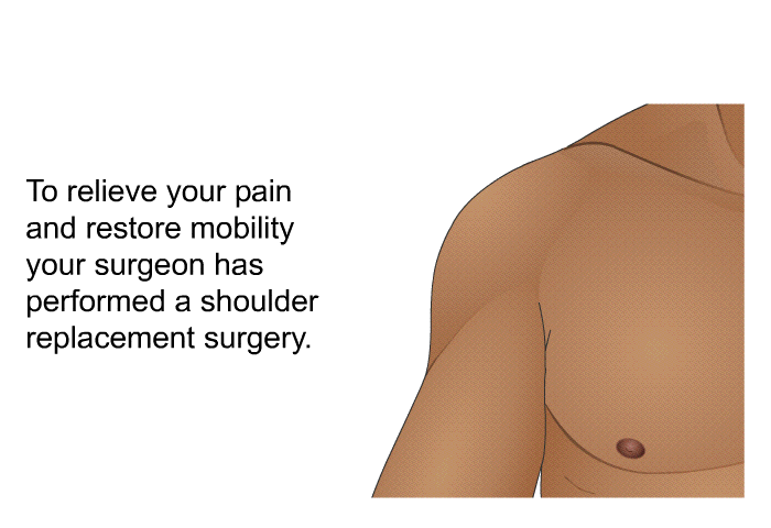 To relieve your pain and restore mobility, your surgeon has performed a shoulder replacement surgery.