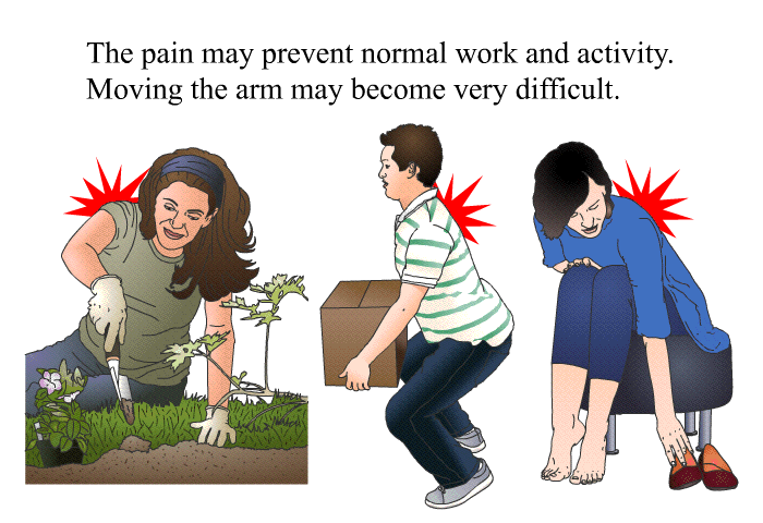 The pain may prevent normal work and activity. Moving the arm may become very difficult.